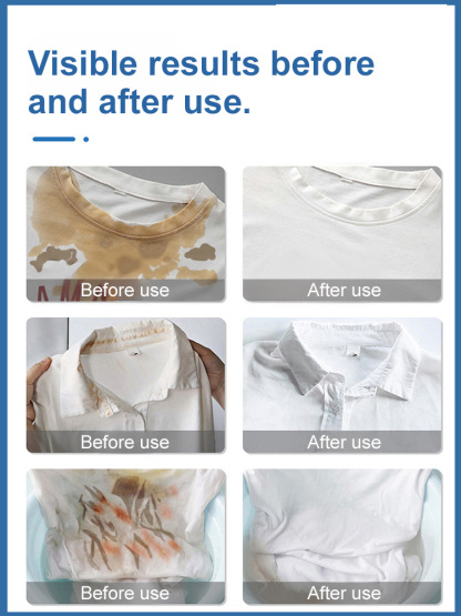 [Turn old clothes into new clothes] Detergent for stain removal and brightening