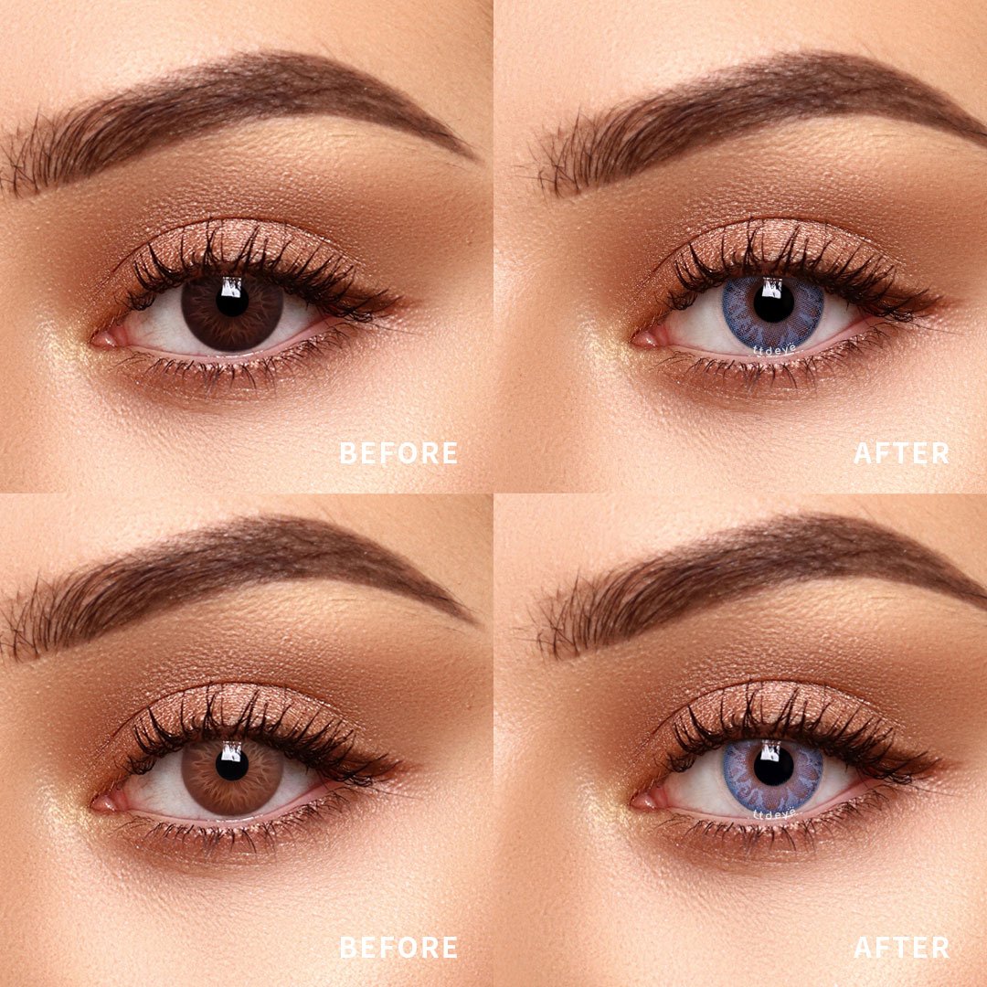 TTDeye Daisy Blue | 1 Year