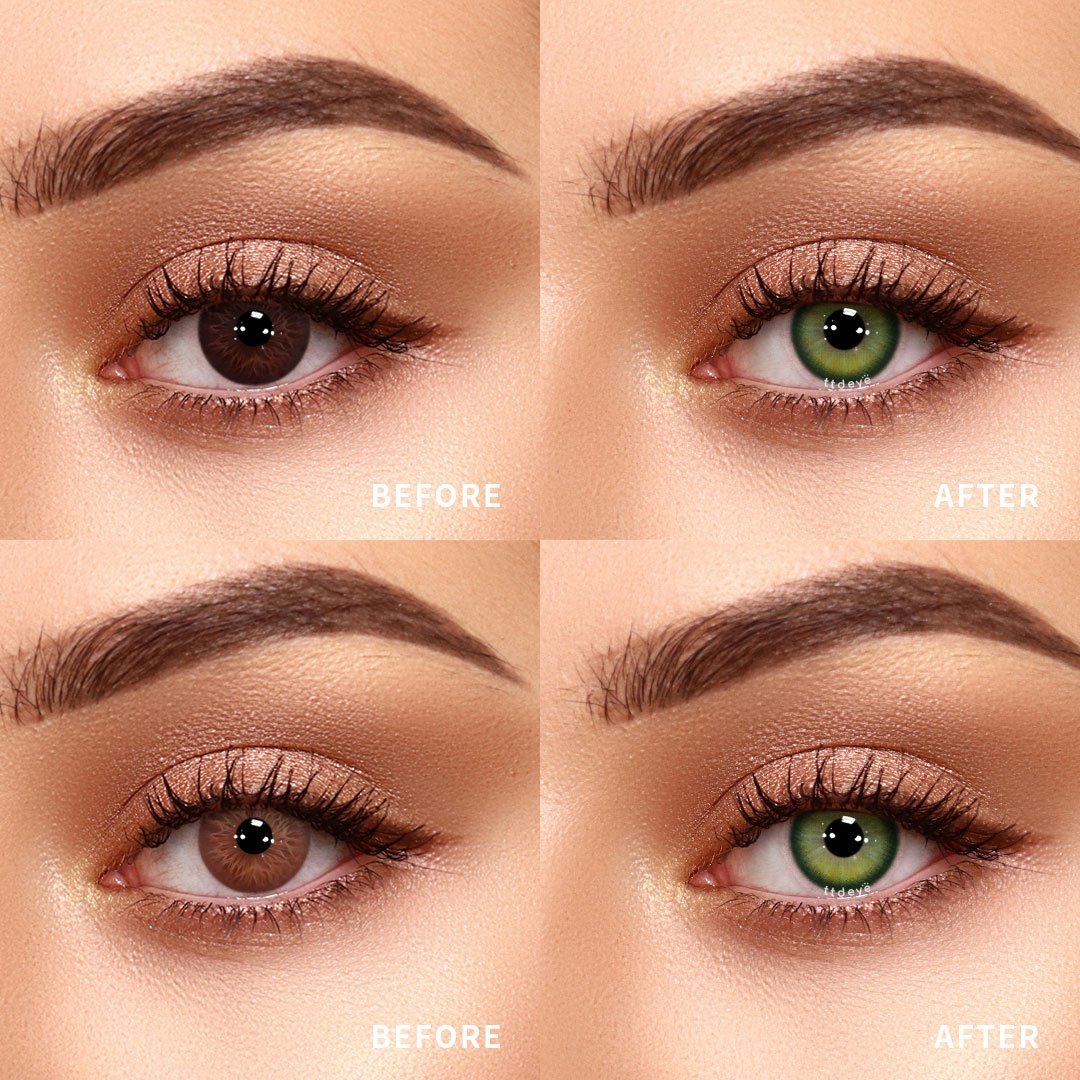 TTDeye Dappled Green | 1 Year