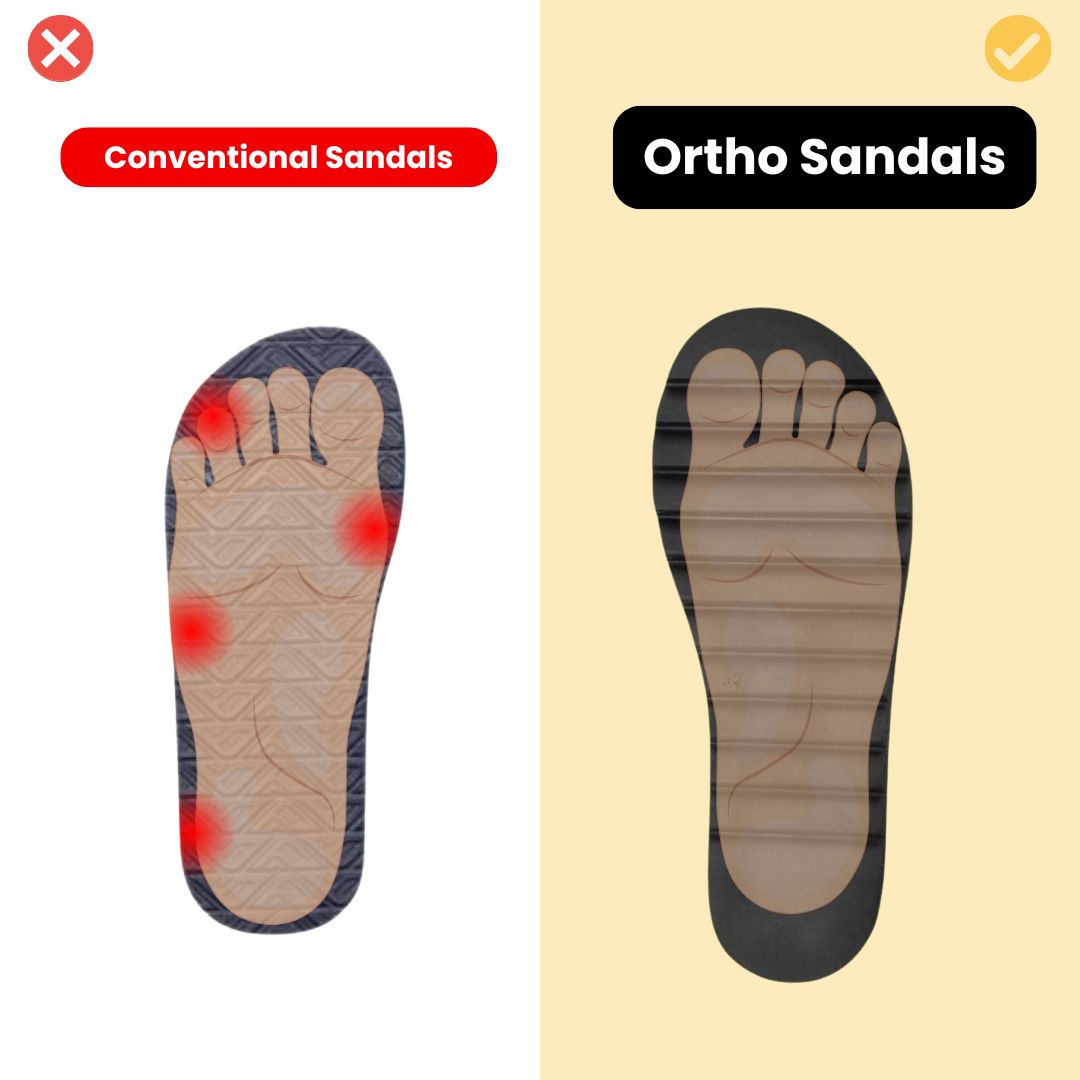 Orthofit™ Sandals - Woman Ultra-Comfy sandals