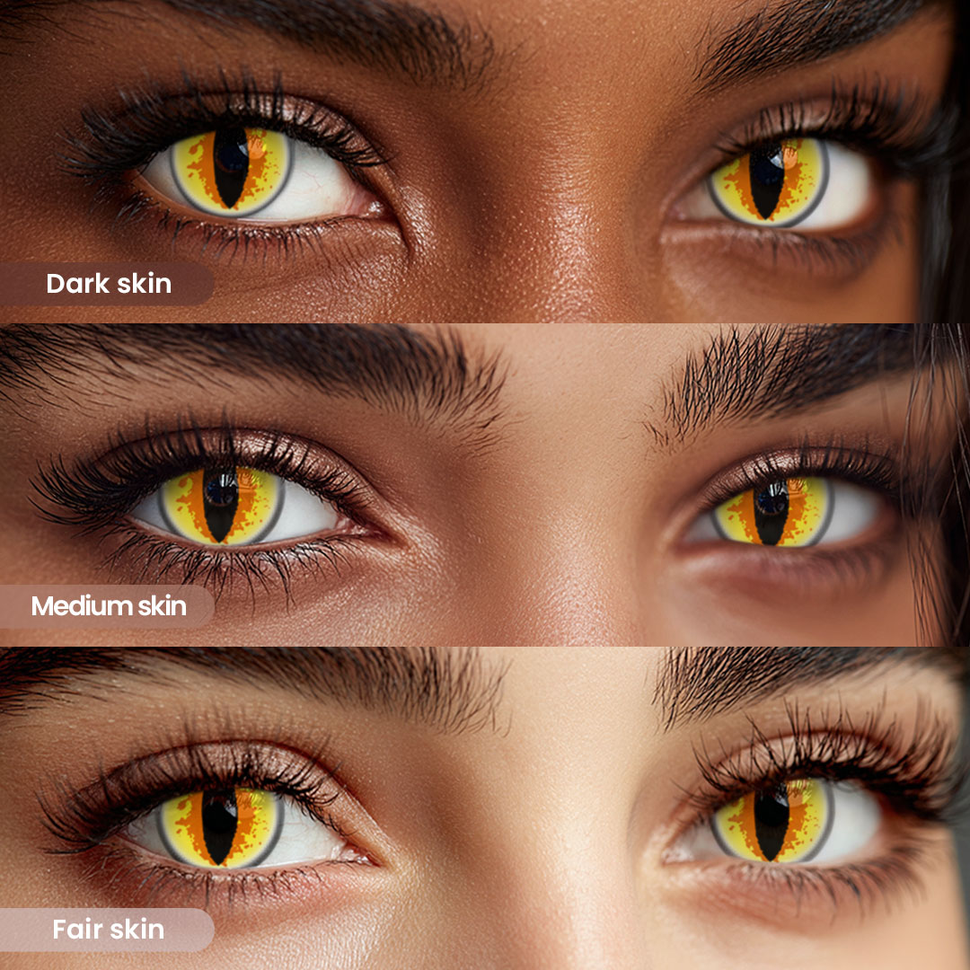 TolyTolly Nyla Yellow| 6-Month