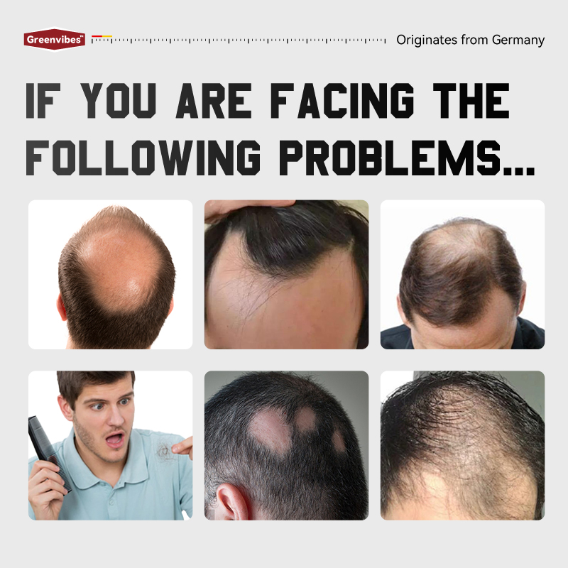  Kreain® HAIR CARE ESSENCE