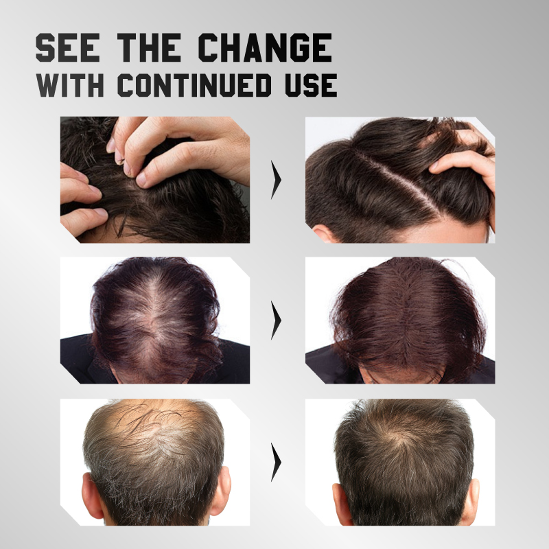  Kreain® HAIR CARE ESSENCE