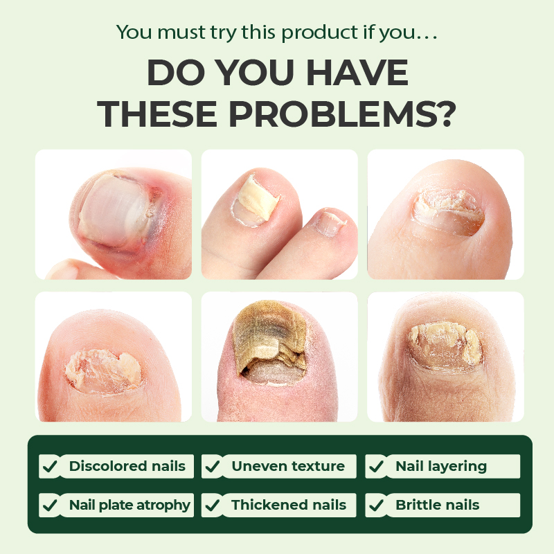 Kreain Nature™ Nail Care Serum