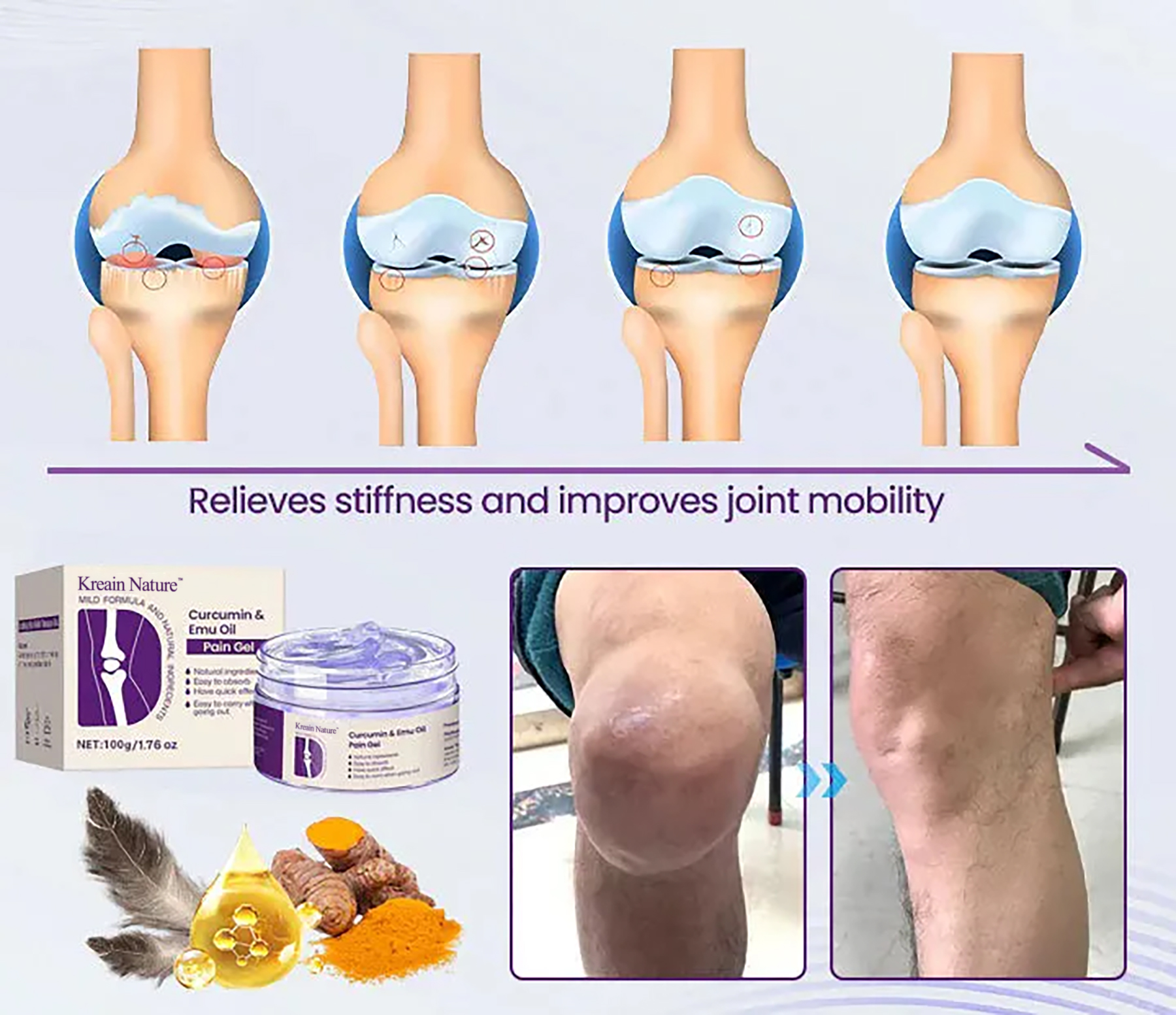 🔥Limited-time discount [70% OFF] Kreain®Joint Gel