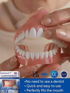 Naturally Sitting Dentures