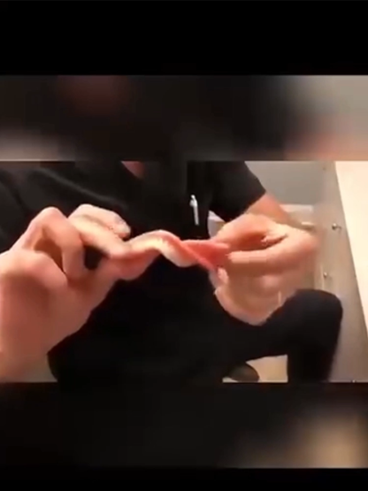 [America's Most Popular Dentures] Dentures that Improve Facial Smile