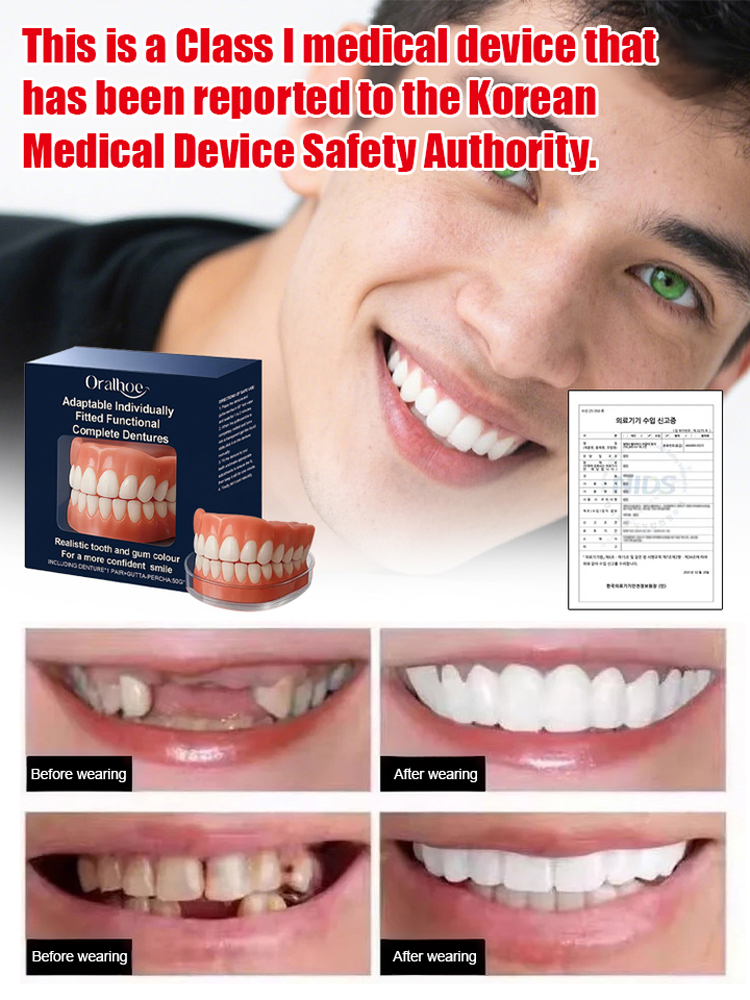 Functional complete denture restoration kit 
