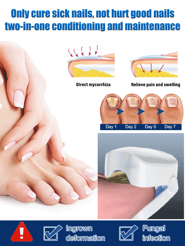 Nail Fungus Cleaning Laser Treatment Device