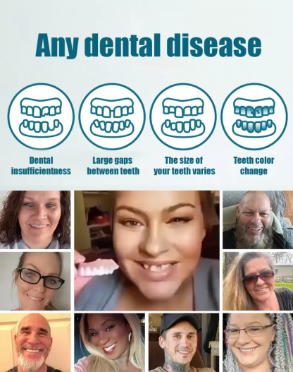 🍎✨10-Second Facial Reconstruction — Fill Your Wrinkles & Smooth Your Smile! Look 20 Years Younger Instantly! 