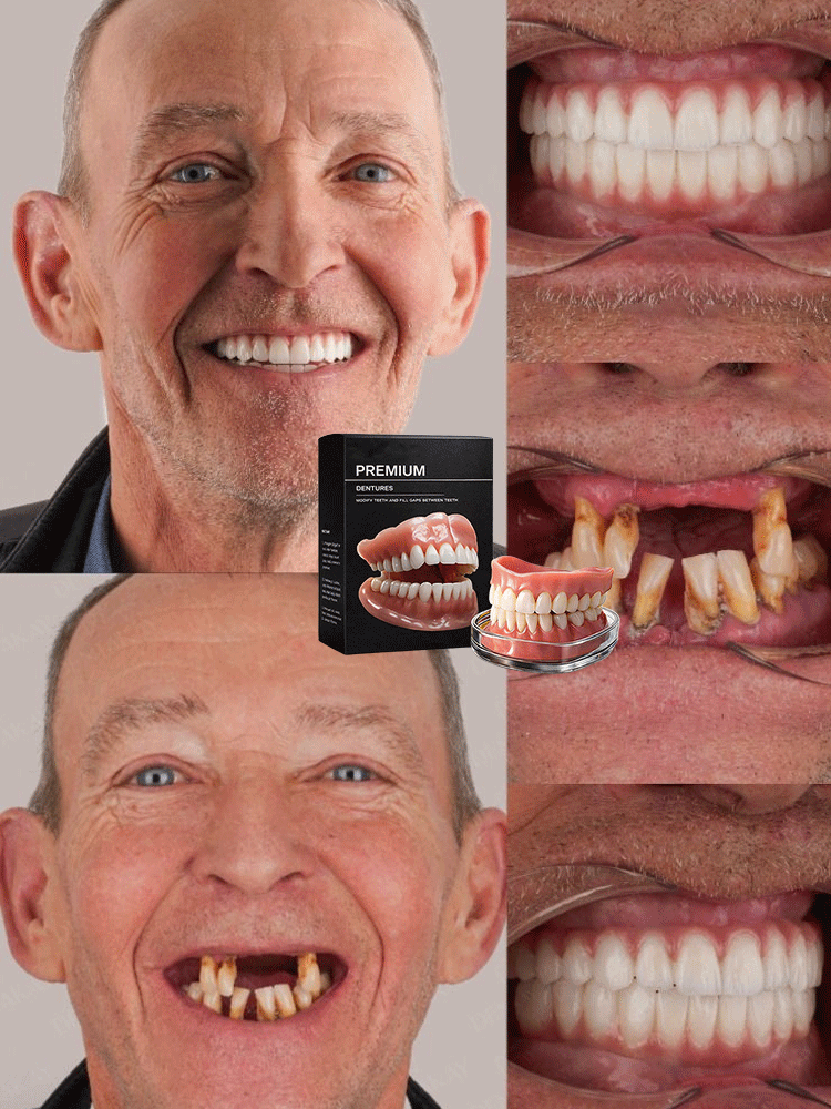 Confident Smile: Full-Function Dentures
