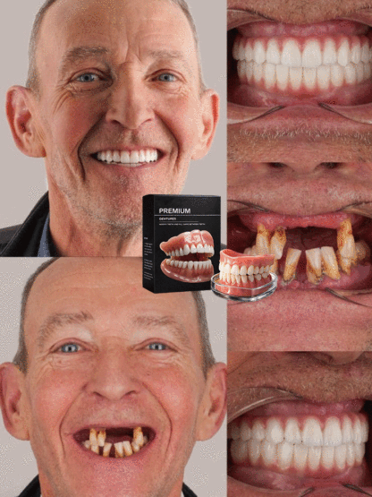 Confident Smile: Full-Function Dentures