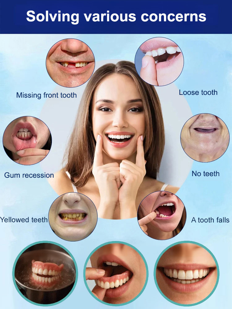 [No Dentist Required] Whitening and Realistic Teeth Whitening Braces