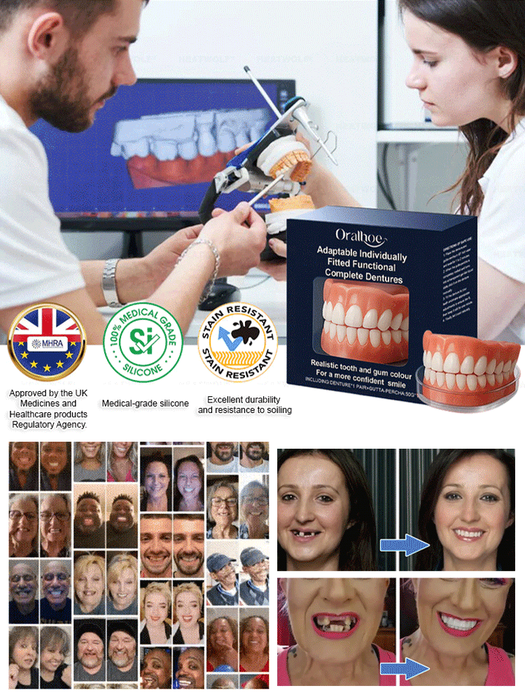 Functional complete denture restoration kit 