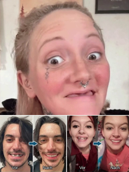 Naturally Sitting Dentures