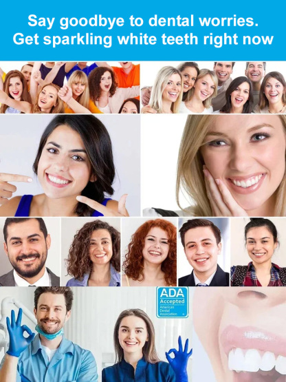 [No Dentist Required] Whitening and Realistic Teeth Whitening Braces