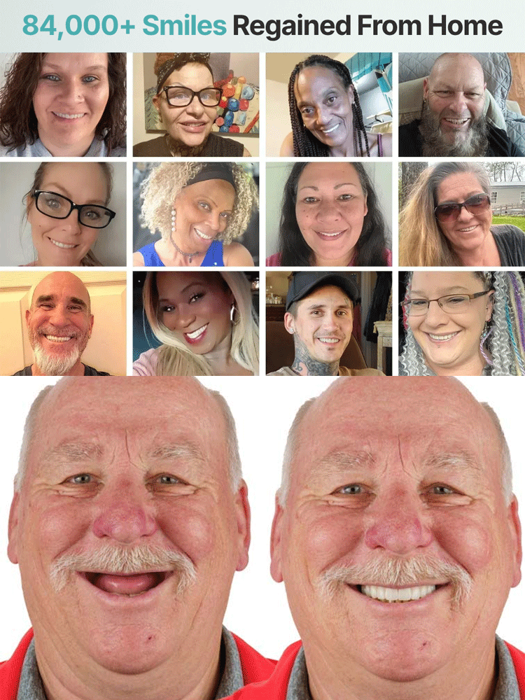 【Best-Selling】Self-Adjusting Fake Denture Set