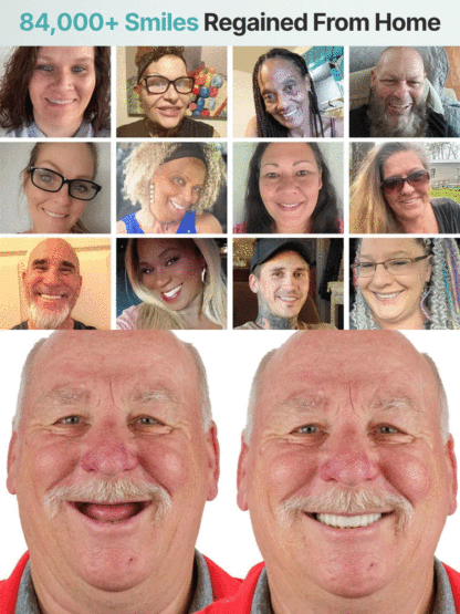 【Best-Selling】Self-Adjusting Fake Denture Set