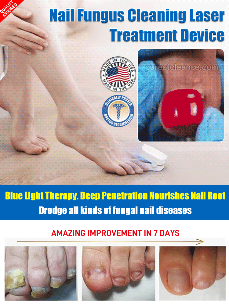 Nail Fungus Cleaning Laser Treatment Device