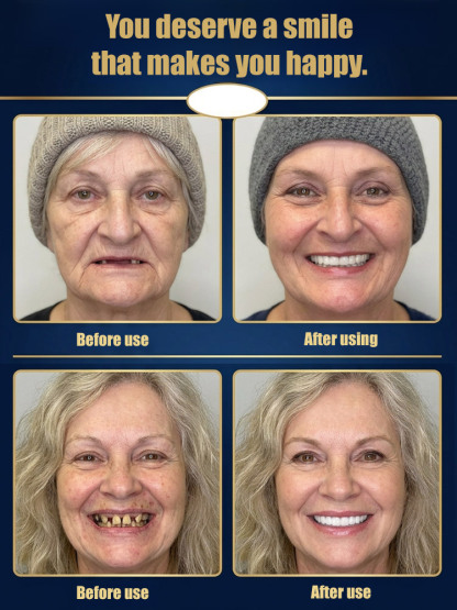 [America's Most Popular Dentures] Dentures that Improve Facial Smile