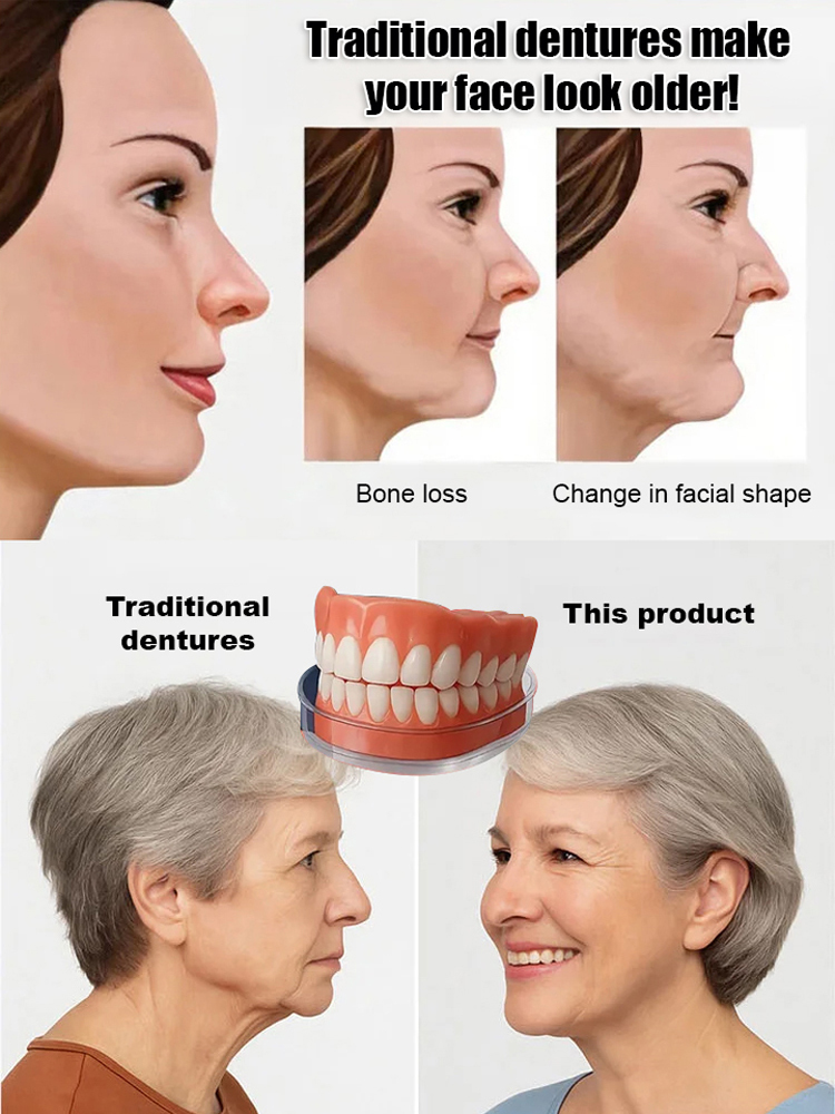 Functional complete denture restoration kit 