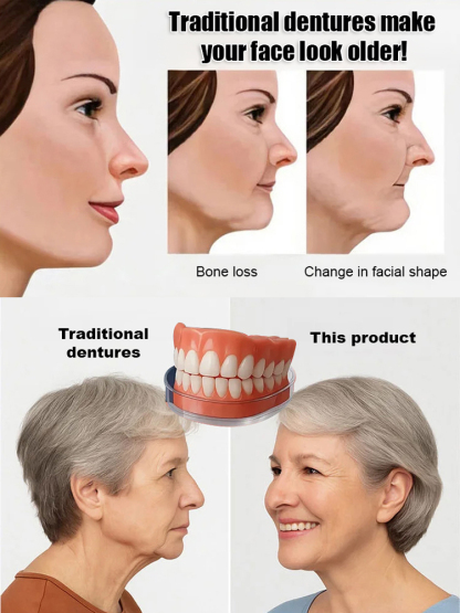 Functional complete denture restoration kit 