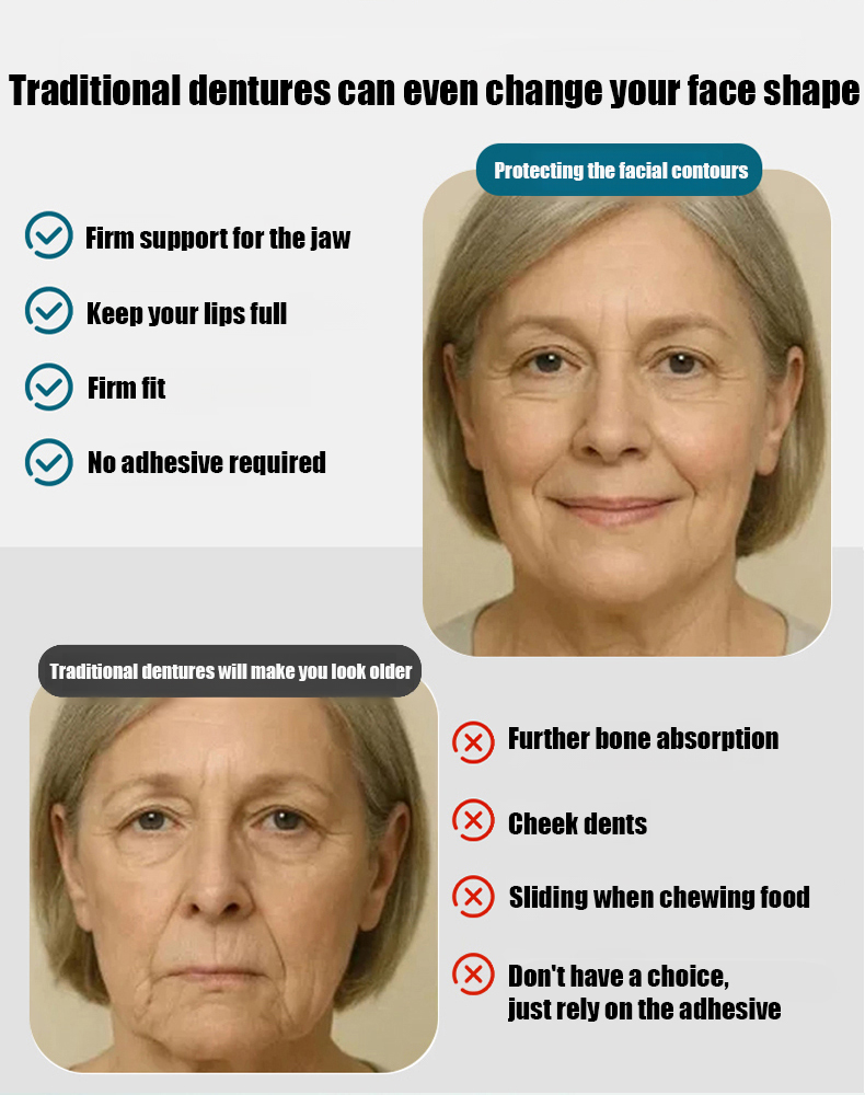 【Nationally Certified Eco-Friendly Antibacterial Material】Full Denture Restoration Kit