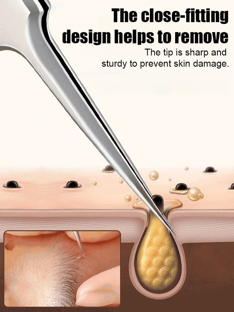 German Precision Beauty Salon Cell Clamp