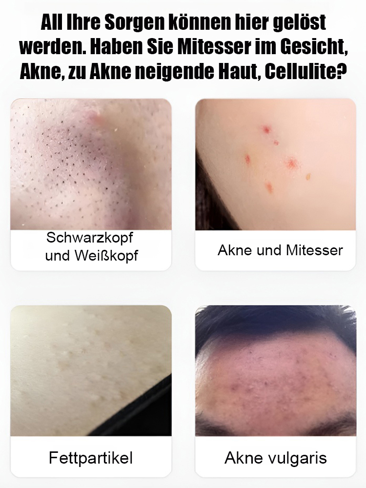 Deutsche Präzisions-Schönheitssalon-Zellklemme