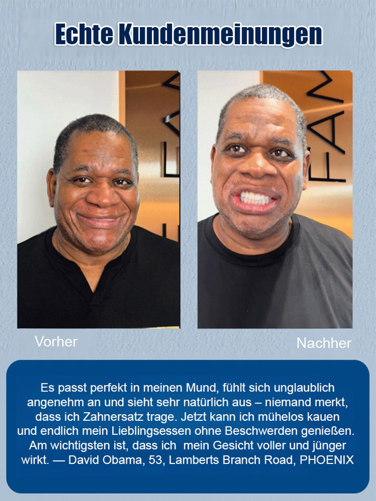 DIYCOS Zahnersatz Dekoration Bühnenmake-up