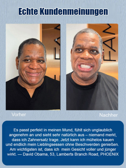 DIYCOS Zahnersatz Dekoration Bühnenmake-up