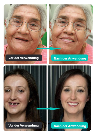 Deutsch: Medizinisches Zahnprothesen-Set mit US-Patent