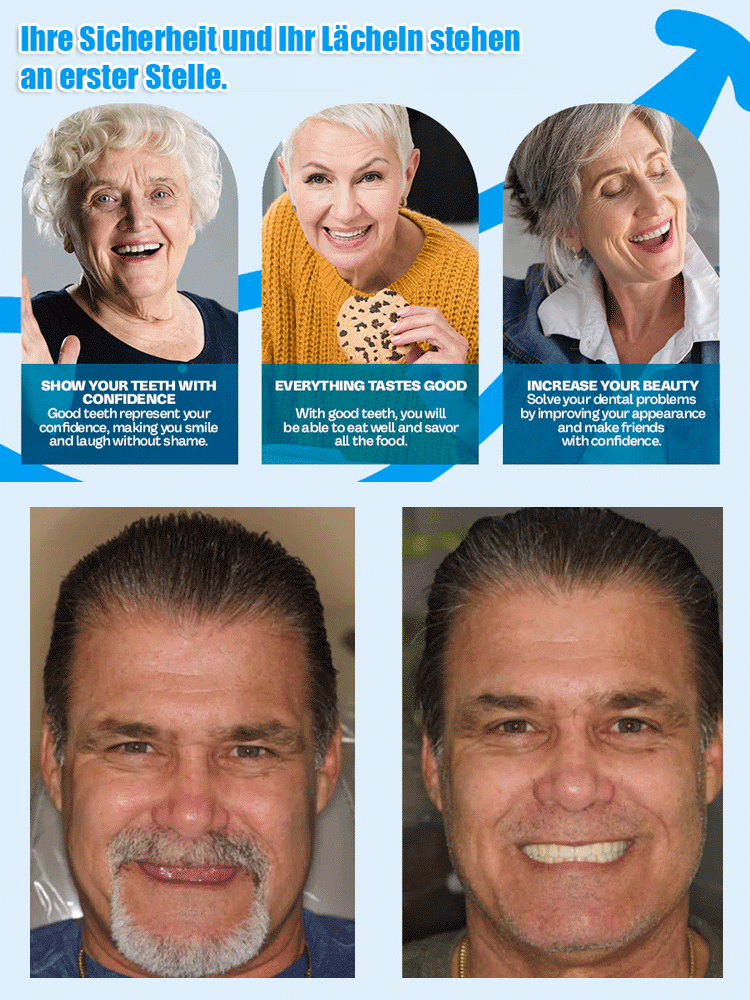 DIYCOS Zahnersatz Dekoration Bühnenmake-up