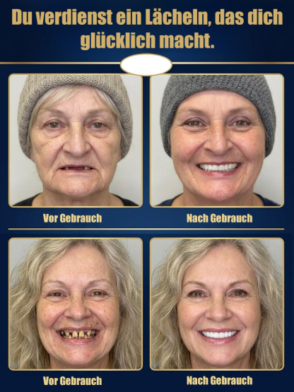 Die beliebtesten Zahnersatzschienen in den USA: Verbesserung des Lächelns mit Zahnersatzschienen.