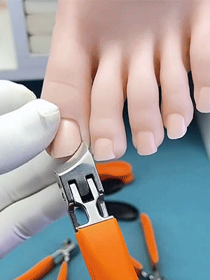 FM【Für eingewachsene Nägel unverzichtbar】Großer schräger Nagelknipser mit Spritzschutz