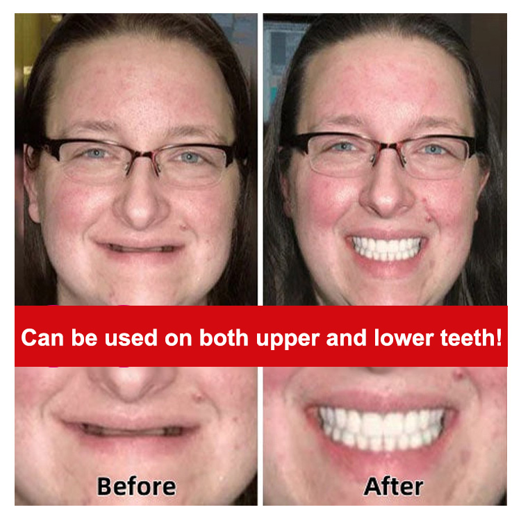 Denture Retouching Beauty Kit