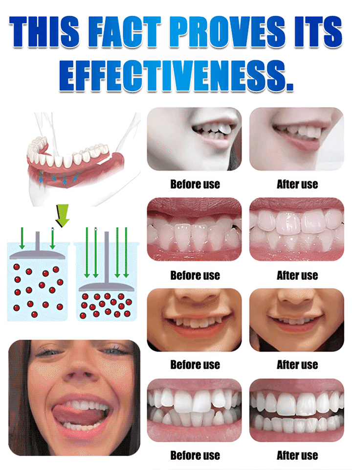 Confident Smile Silicone Denture Kit