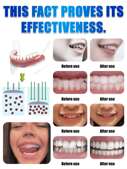 Confident Smile Silicone Denture Kit