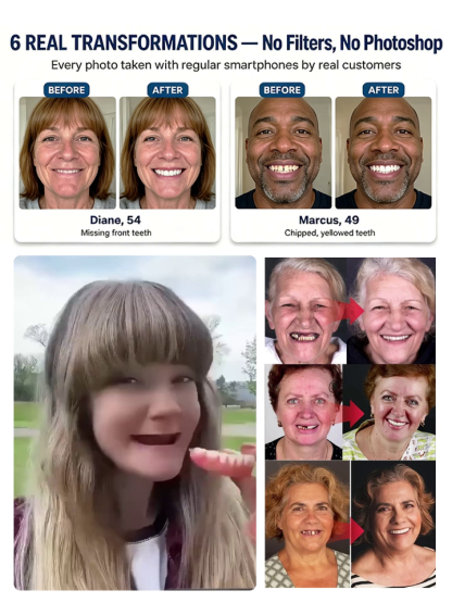 Premium Smart Custom Dentures: 2-Minute At-Home Molding, Vacuum Lock, Eat Anything Without Slipping!