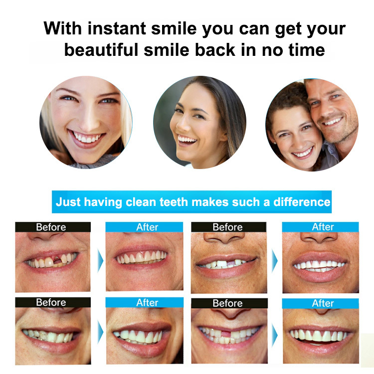 Denture Retouching Beauty Kit