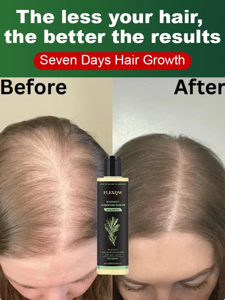 ⭐[The less hair, the better the effect] Herbal Essence Nourishing Repair Shampoo.👩‍⚕️Doctor-recommended! Formulated for thinning hair and severe hair loss.🌿Infused with rosemary + cinnamon extract—even bald spots grow new hair!