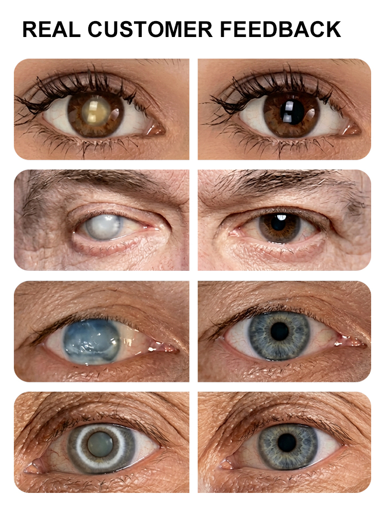 Instant correction for clear eyesight