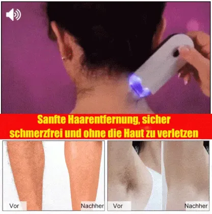 【For Both Men & Women】Smart Painless Hair Removal Device – Achieve Smooth, Radiant Skin in 10 Seconds!