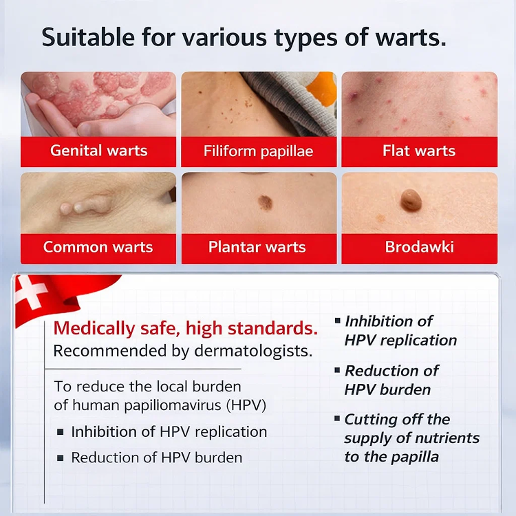 Wart Removal Cream