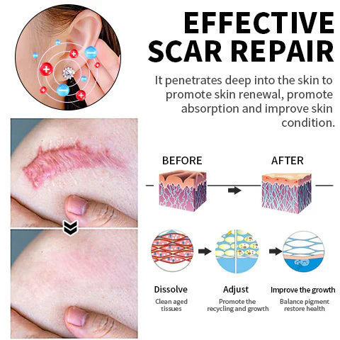 Histone Moissanite Diamond Titanium Earrings(Limited Time Discount 🔥 Last Day)-WAIOLTD