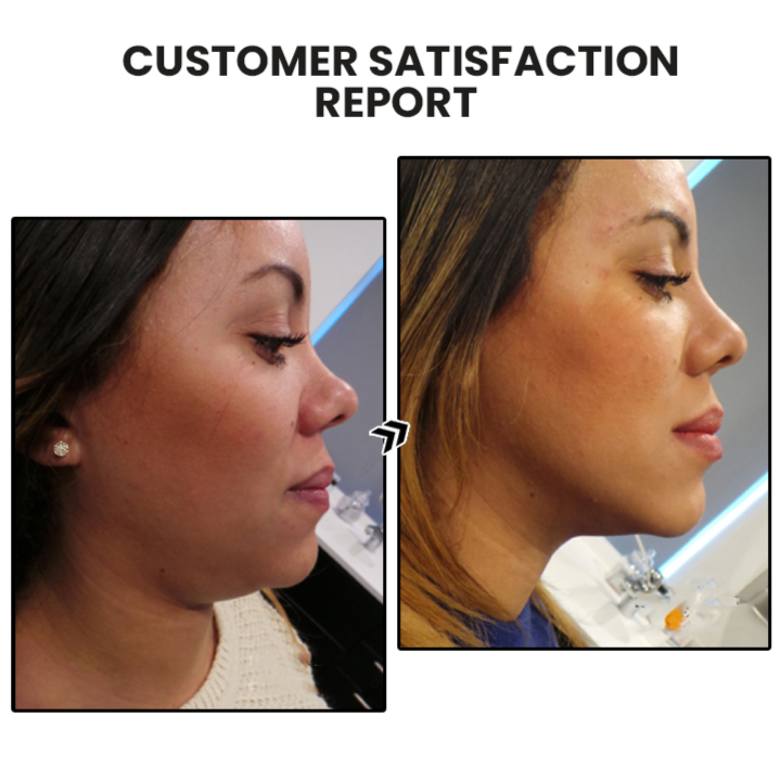 🔥LAST DAY SALE-80% OFF)Histone EarAcupressure Magnetherapy Detoxi Earrings-WAIOLTD