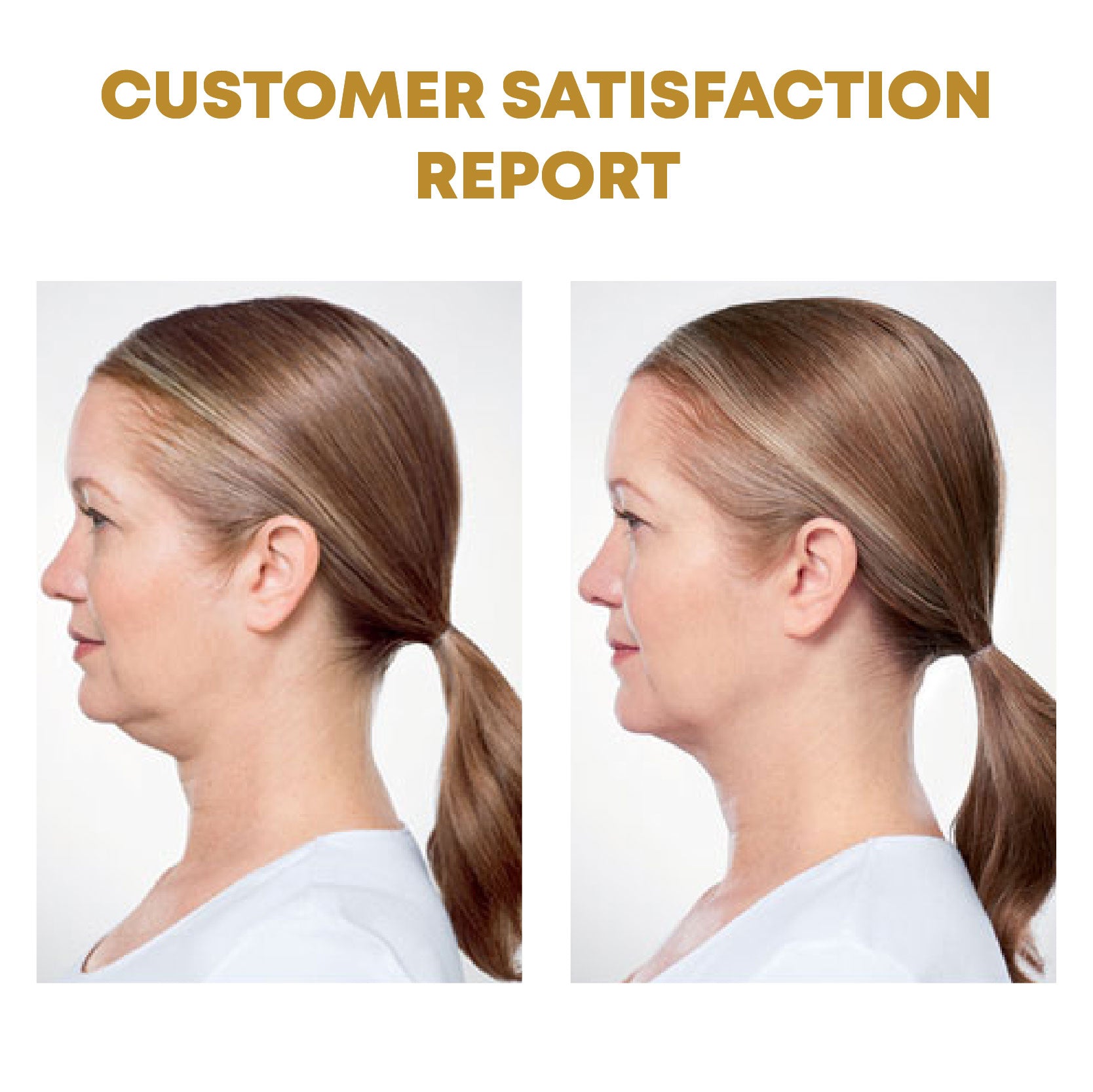 🔥LAST DAY SALE-80% OFF)Histone Elegance Lymphvity MagneTherapy White Onyx Earrings-WAIOLTD