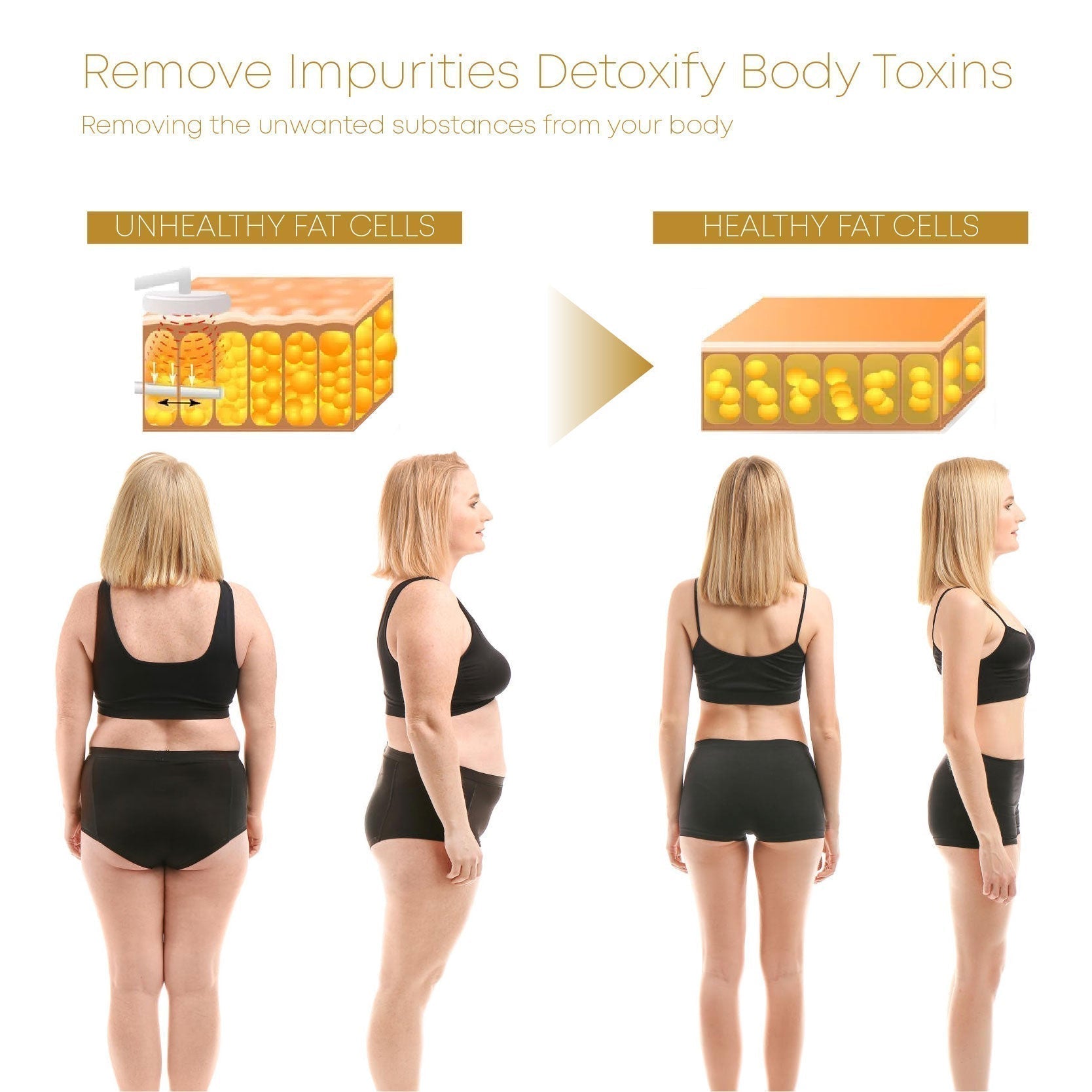 🔥LAST DAY SALE-80% OFF)Histone Elegance Lymphvity MagneTherapy White Onyx Earrings-WAIOLTD