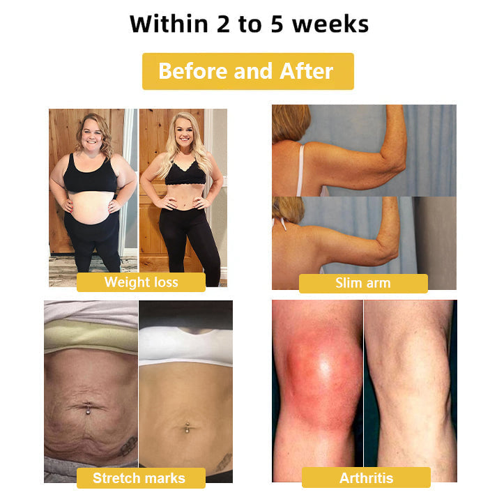 Christmas Limited Time Offer🎄 - Up to 90% OFF! 🎅DIYSTAR Lymphatic Magnetic Therapy Cat's Eye Ring