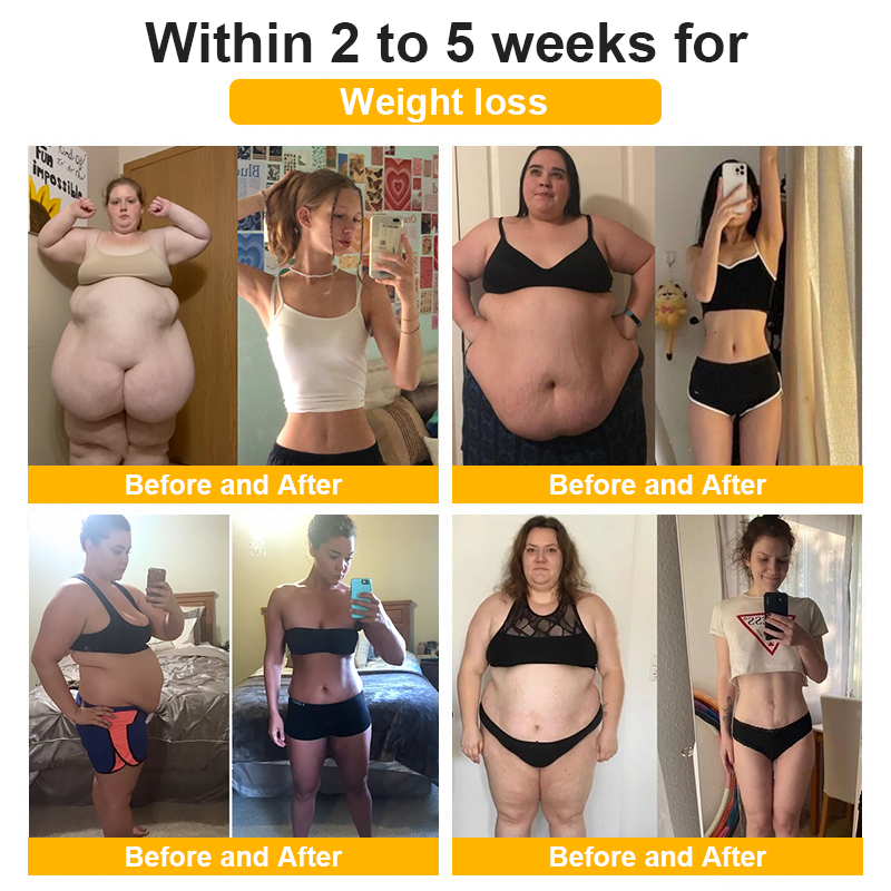 Christmas Limited Time Offer🎄 - Up to 90% OFF! 🎅DIYSTAR Lymphatic Magnetic Therapy Cat's Eye Ring